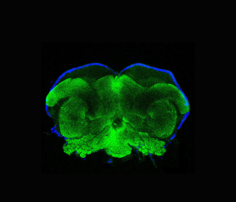 Worker termite brain